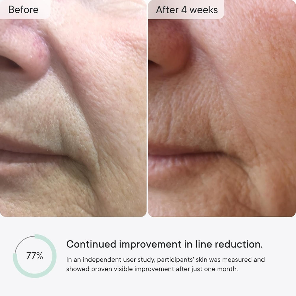 GlowBeauty™ – Micro-Infusion Anti-Wrinkle Patches