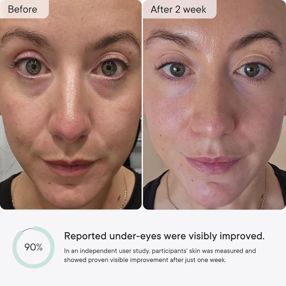 GlowBeauty™ – Micro-Infusion Anti-Wrinkle Patches